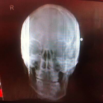 Die Opfer des Snipers