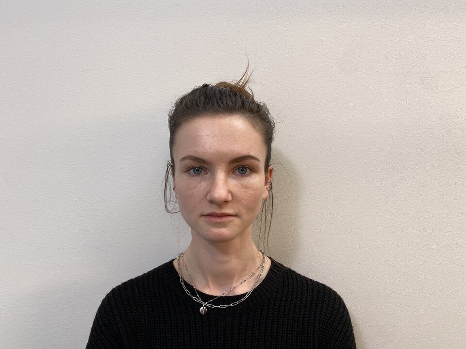 Gliding Brow Lift: Das neue Lifting der Brauen