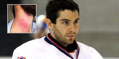 Eishockey-Goalie twittert Schock-Bild