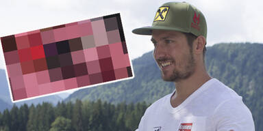 Hirscher