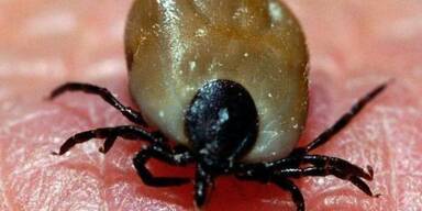 Garten und Park werden oft untersch&auml;tzt