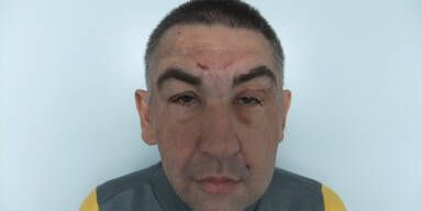 Ged&auml;chtnislos Unbekannt