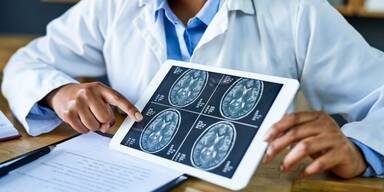 Scheinbare Coronainfektion erwies sich als Tumor