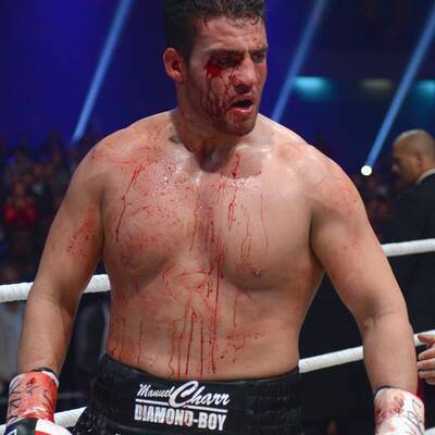 Vitali Klitschko vs. Manuel Charr