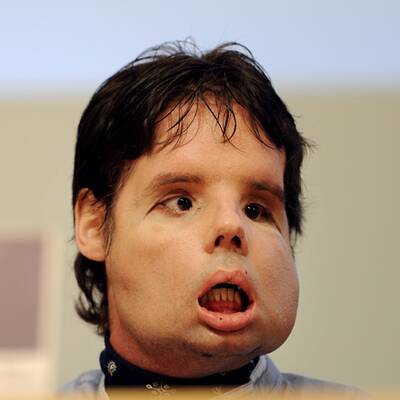 Oscar mit seinem neuen Gesicht