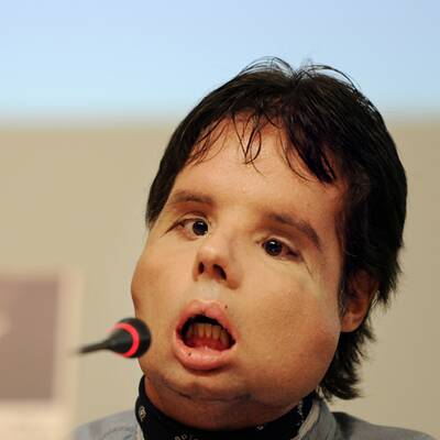 Oscar mit seinem neuen Gesicht