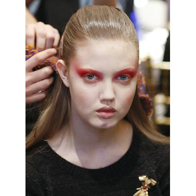 Lindsey Wixson erleidet Allergie-Schock