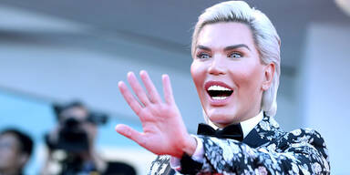 L&auml;sst sich lebender Ken f&uuml;r 4 Mio. Euro den Penis entfernen?