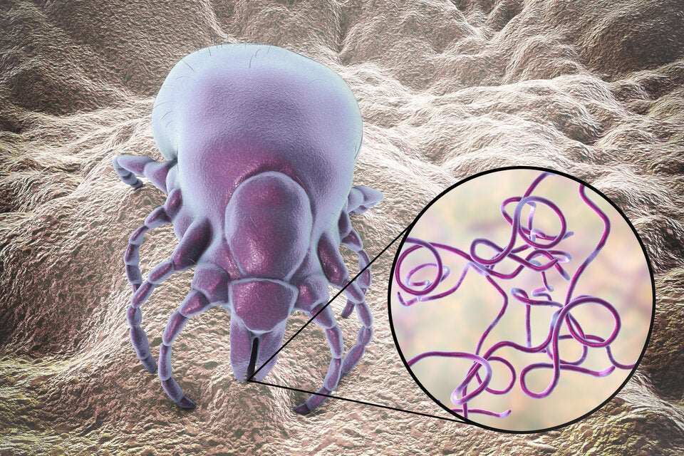 Noch ist der beste Schutz gegen Borreliose, einen Zeckenstich zu vermeiden. Doch ab 2025 könnte endlich eine Schutzimpfung verfügbar sein.