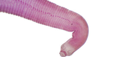 DIESE W&uuml;rmer fechten mit ihren Penissen, Verlierer wird zum Weibchen