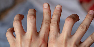 Wenn sich die Finger kr&uuml;mmen