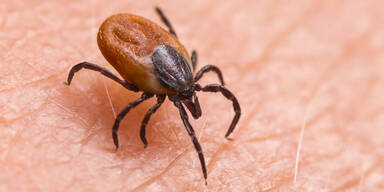 Klimawandel sorgt f&uuml;r Zecken-Alarm in N&Ouml;