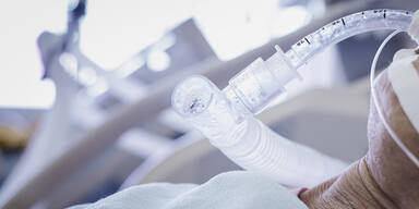 BEatmungsger&auml;t Intubieren