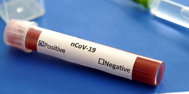 Corona-tests