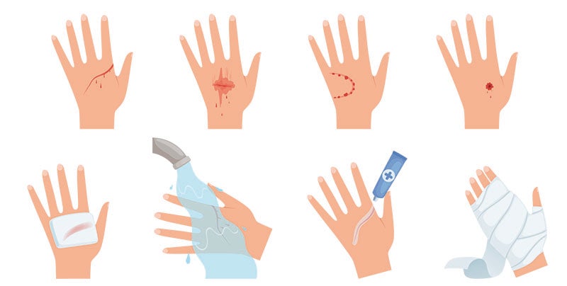 Gut ausgestattet: Erste Hilfe für zuhause