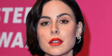 Schock: Lena Mayer-Landrut verlor ihre Haare