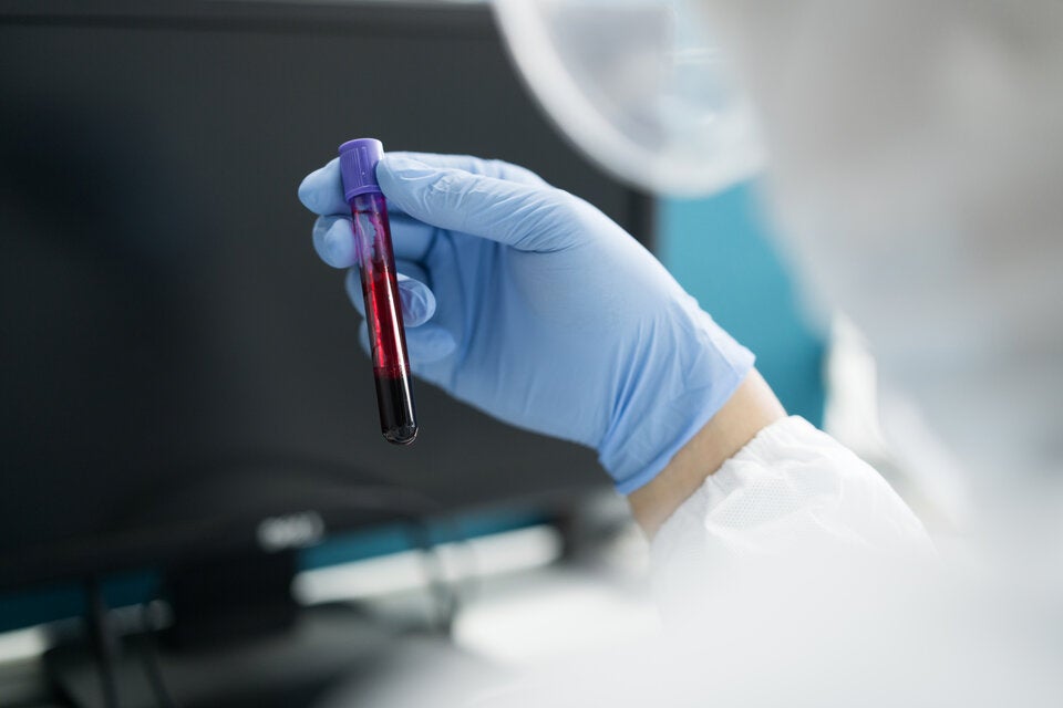 Die neue Blutgruppe „Gwada negativ“ wurde bei einer Frau mit Wurzeln in Guadeloupe entdeckt.