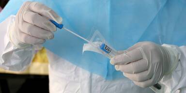 Zahl der Reinfektionen durch Omikron-Variante h&ouml;her