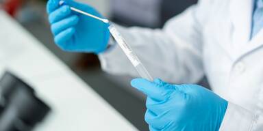 Corona Test im Labor