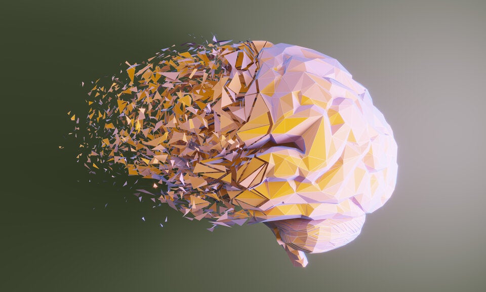 Neue Alzheimer-Hoffnung: Was das neue Medikament kann und für wen es geeignet ist