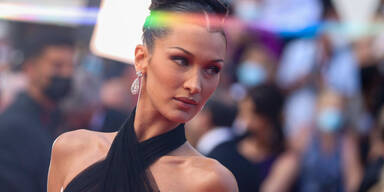 Lyme-Borreliose: Alles über Bella Hadids unheilbare Krankheit