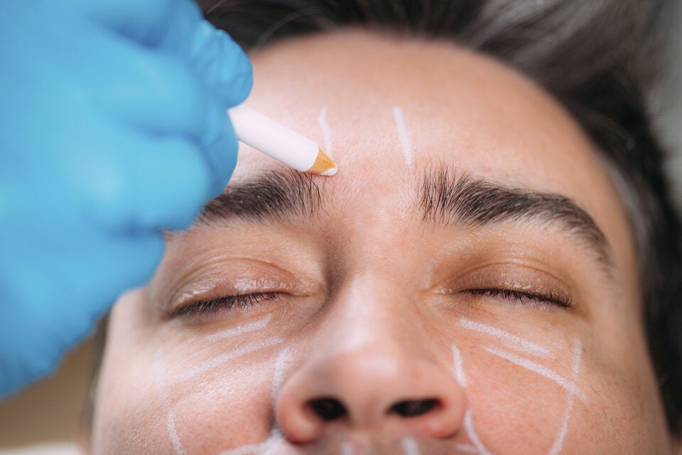 Deshalb werden Schönheits-OPs auch unter Männern immer beliebter