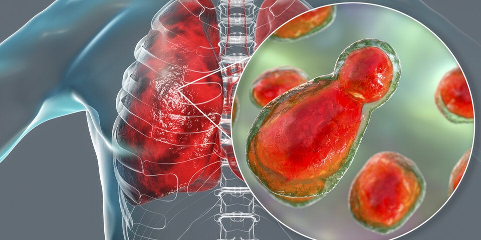 Tag der seltenen Erkrankungen: Primäre Immundefekte