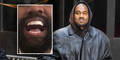 Wie Bond-Bösewicht: Kanye West zeigt sich mit Titan-Gebiss