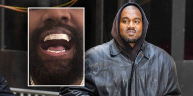 Wie Bond-Bösewicht: Kanye West zeigt sich mit Titan-Gebiss