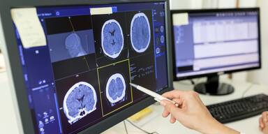 Frauen vs. M&auml;nner: Neue Studie zeigt gro&szlig;e Unterschiede bei Stress & Alkohol