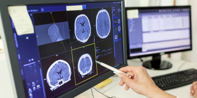 Frauen vs. Männer: Neue Studie zeigt krasse Unterschiede bei Stress & Alkohol