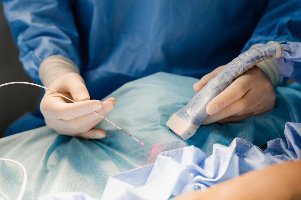 Krampfadern richtig behandeln