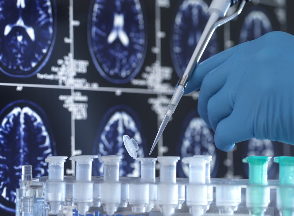 Alzheimer Medikament