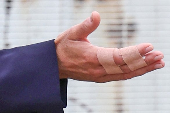 Herzogin Kate verletzt im Gefängnis