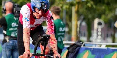 Blut, Knochen und Helm gebrochen! Der h&auml;rteste Radprofi der Welt