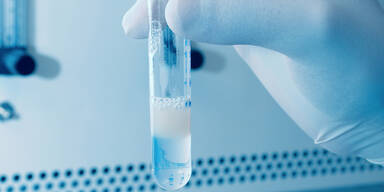 Sperma Spermaprobe
