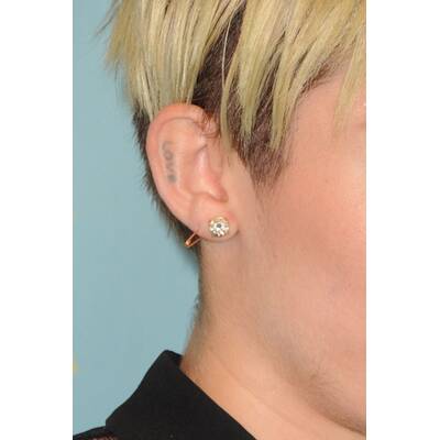 Erkennen Sie die Stars an den Tattoos? 