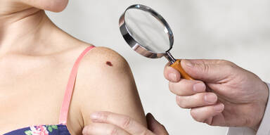 Muttermal-Check demn&auml;chst privat bezahlen