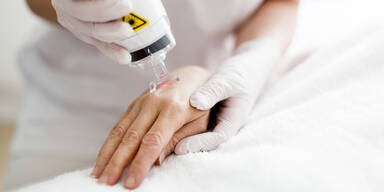 Die Hände sanft verjüngen