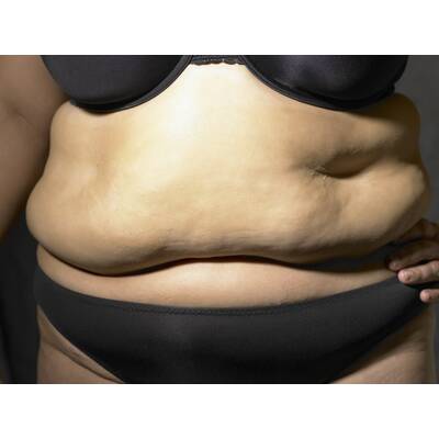 Welcher Bauch-Typ sind Sie