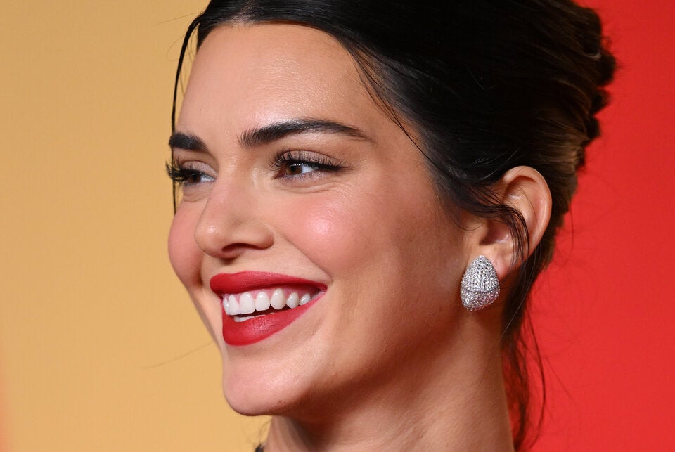 Bei Kendall Jenner sind Lip Flip und Lip Filler eindeutig