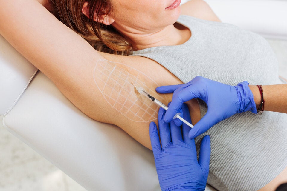 Kleiner Pieks, großer Effekt: Botox kann lokal (z.B. unter den Armen) die Schweißproduktion ausschalten.
