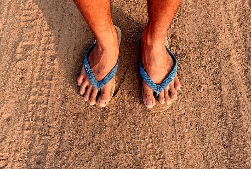 Achtung: So gefährlich sind Flip Flops für unsere Füße
