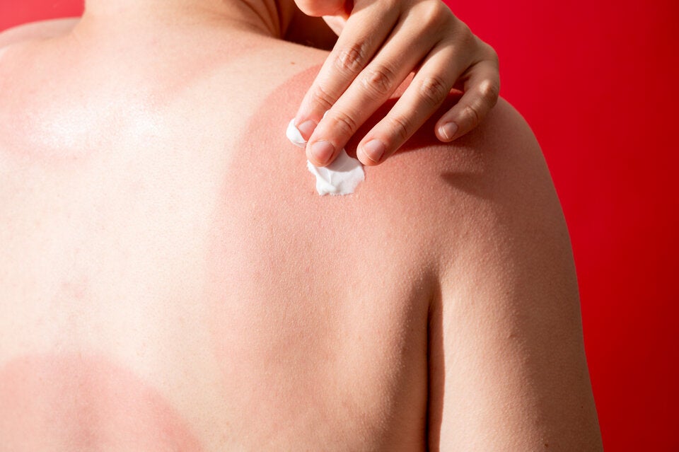 Gut geschützt die Sonne genießen: Diese Tipps müssen Sie beachten