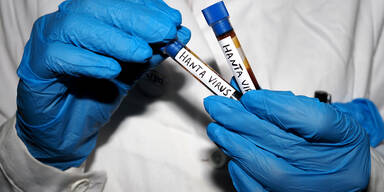 Hantavirus