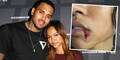 Karrueche Tran: Blutige Lippe