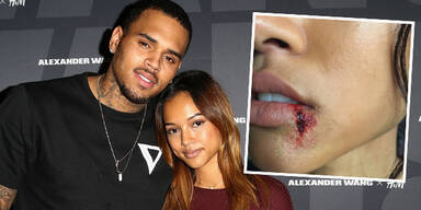 Karrueche Tran: Blutige Lippe