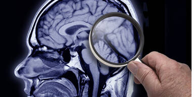 banane alzheimer k&uuml;chenpannen