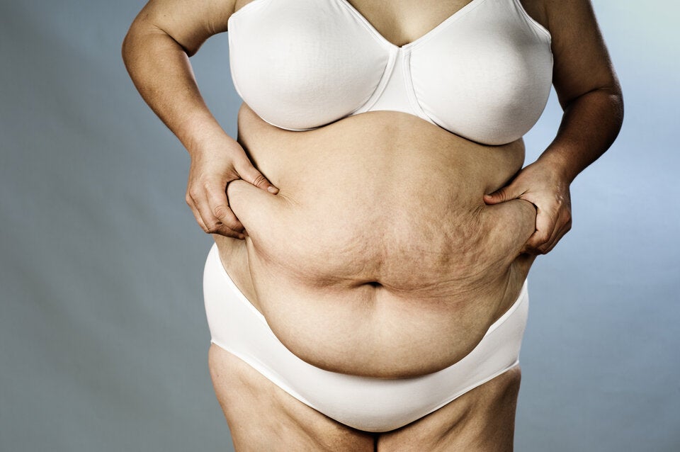 Richtig abnehmen: Welcher Bauchtyp sind Sie?