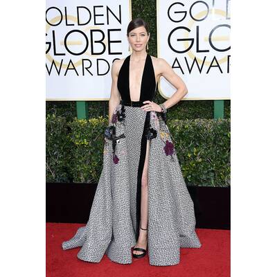 Golden Globe Awards 2017